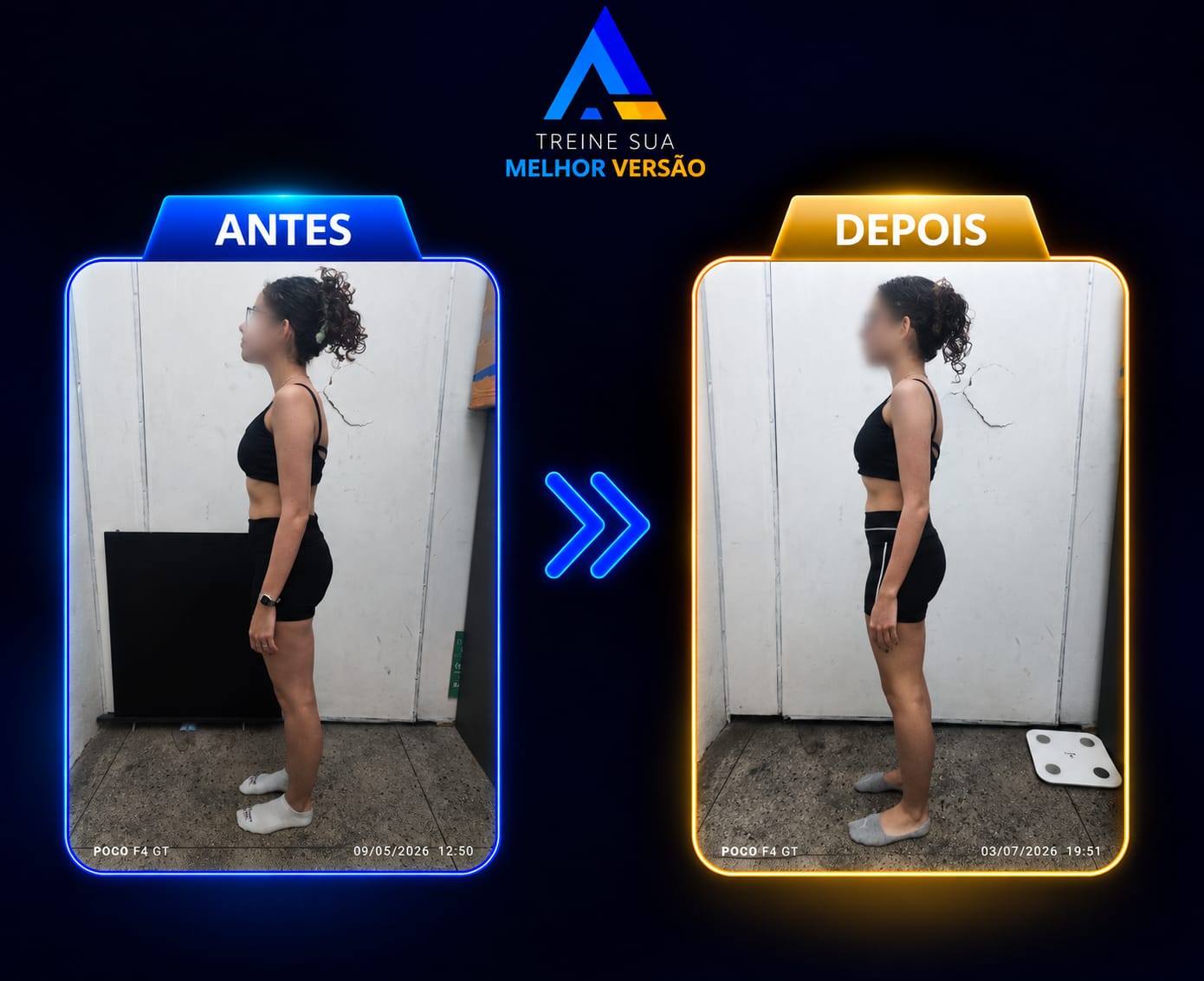 Antes e depois de aluna em processo de recomposição corporal, vista lateral