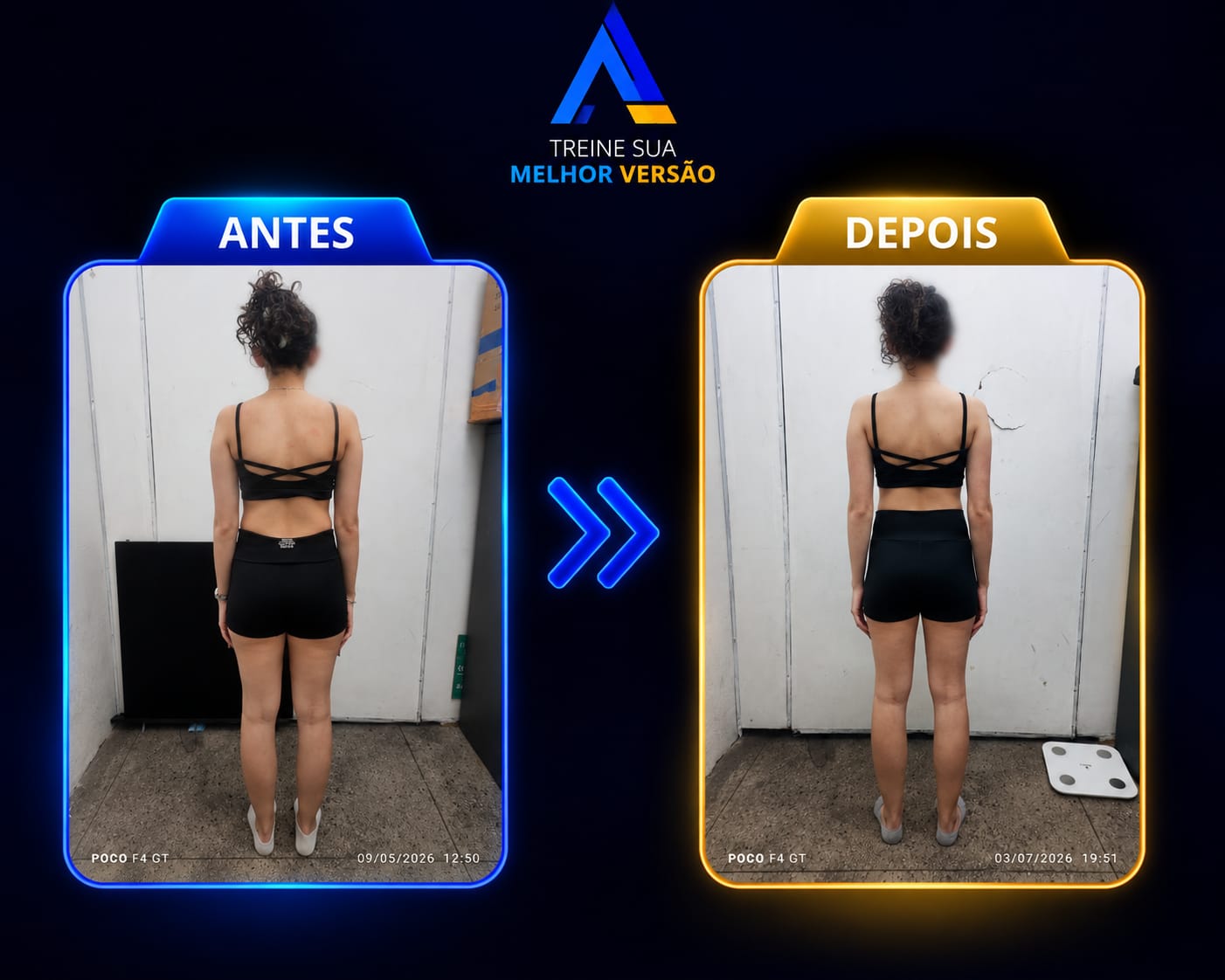 Antes e depois de aluna em processo de recomposição corporal, vista posterior